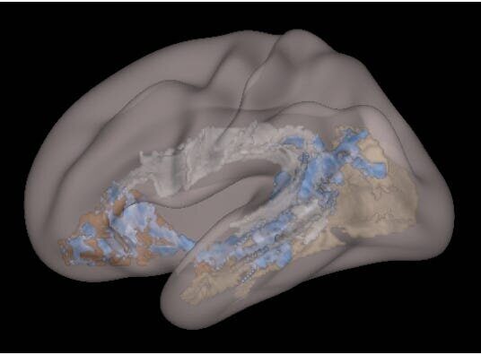 brain-image-for-tech-blog-4126633